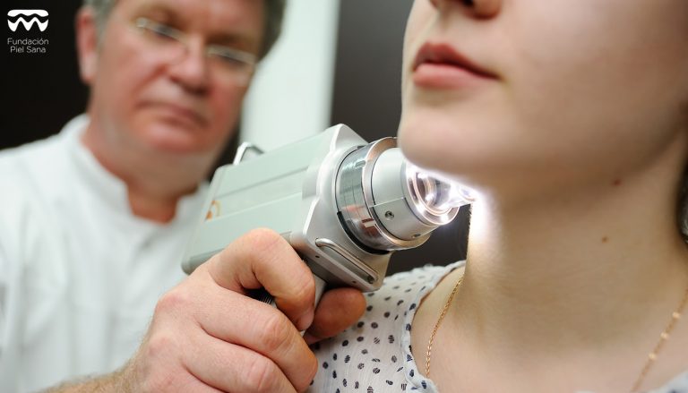 cancer de piel