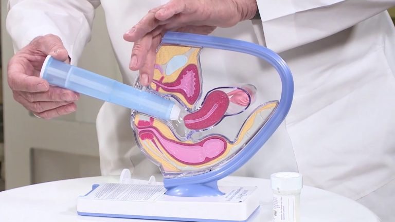 prueba del Papanicolau