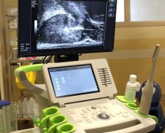 El diagnóstico de cáncer de próstata es un 300% más eficaz con el nuevo ecógrafo de Clínica Santa Elena